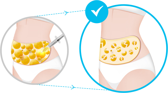 Screen explaining how fat cells are destroyed by ID V-Logic Body PT injection