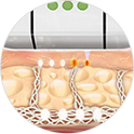 During Ulthera: non-invasive collagen stimulation