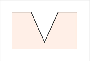 Various shapes of pores and scars - ice pick, rolling, boxcar