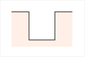 Various shapes of pores and scars - ice pick, rolling, boxcar