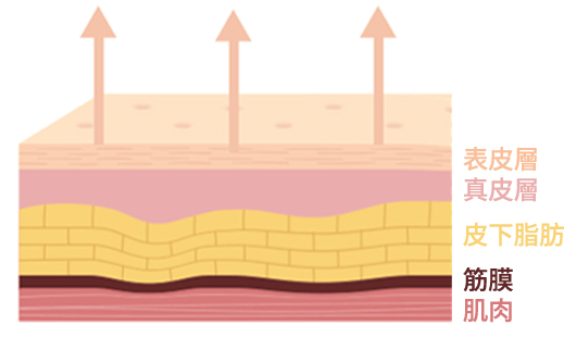 Skin layer illustration explaining how regular thread lifting lifts only the surface