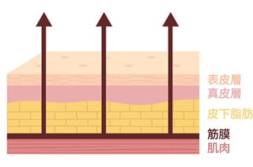 Skin layer illustration explaining how Mint thread lifting lifts deeply from the SMAS layer