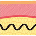 Evolution of thread lifting structure from 1st to 4th generation