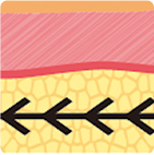 Evolution of thread lifting structure from 1st to 4th generation