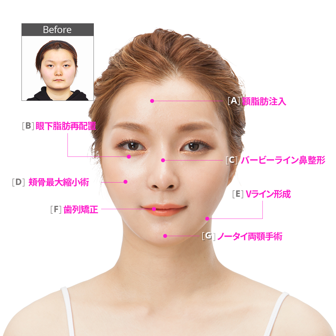 韓国id美容外科-安全な手術