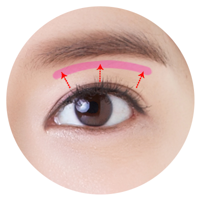 id-眼瞼下垂手術-眉リフト
