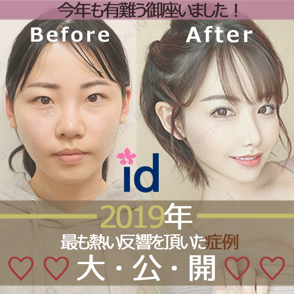 Thanks 19年 今年人気があった日本人症例写真をご紹介 韓国 Id美容外科