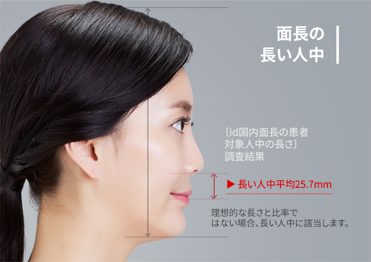 人中短縮 顔の長さを短くする 韓国美容整形 Id美容外科