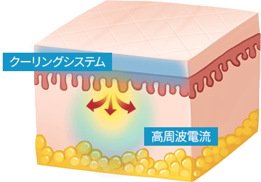 피부