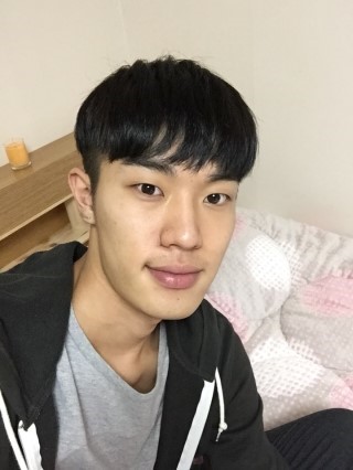 面長で非対称だった顔 両顎手術で改善できました 男性美容整形ビフォーアフター 韓国 Id美容外科